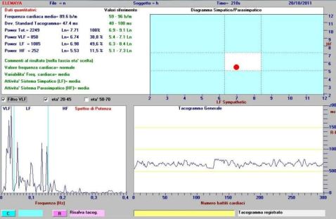 La gestione dell'attivazione con il biofeedback